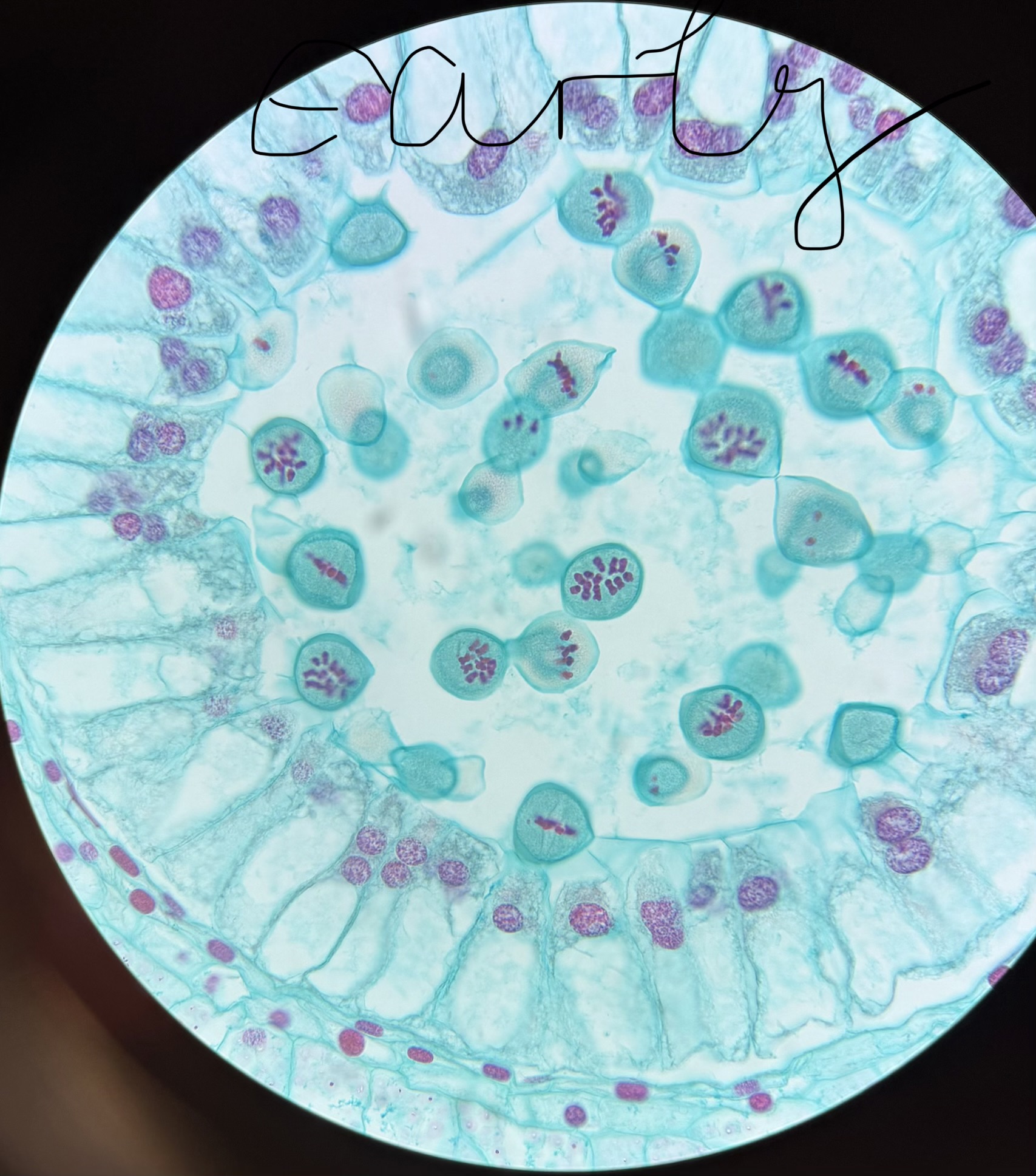 Observing the Stages of Meiosis See pictures for