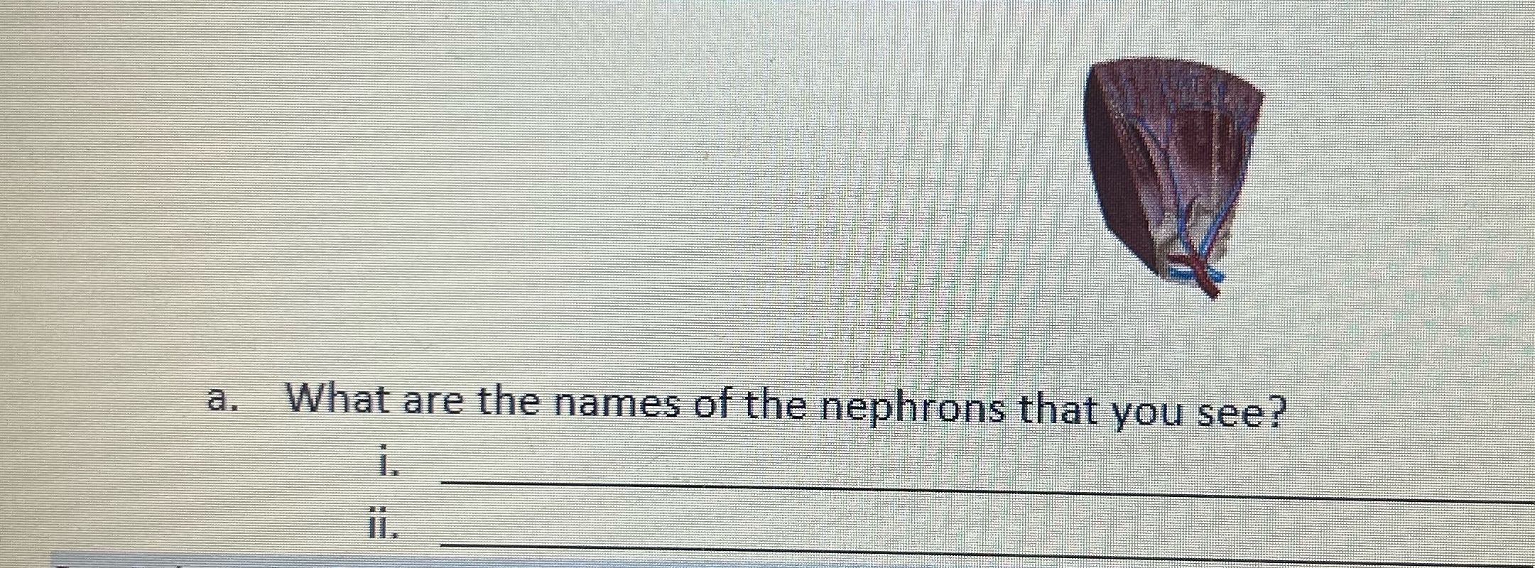 What are the names of the nephrons that you see