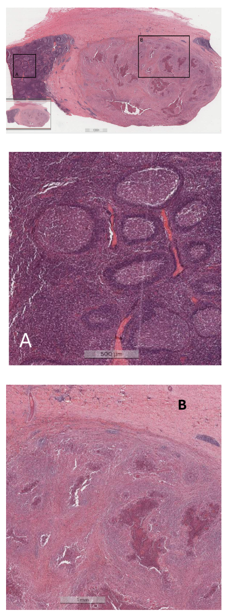 I need some clarification for this histology