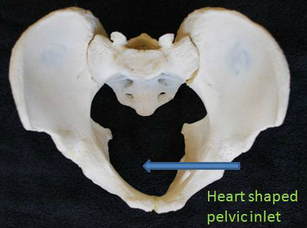 Does this os coxa belong to a male or a female?