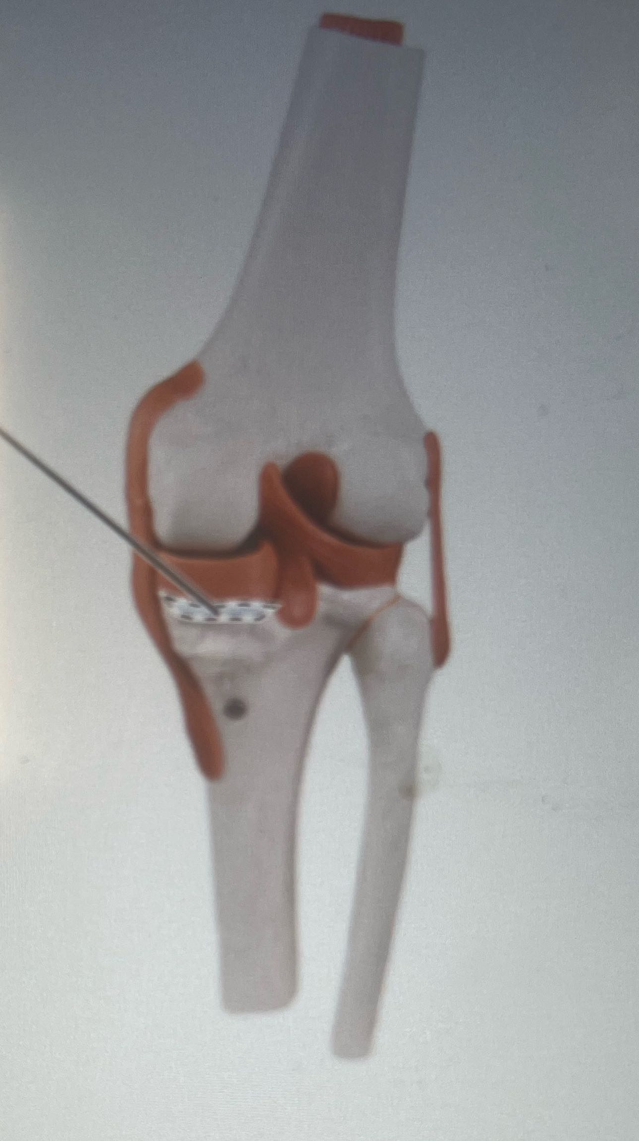 What is this indicated by the dotted line on