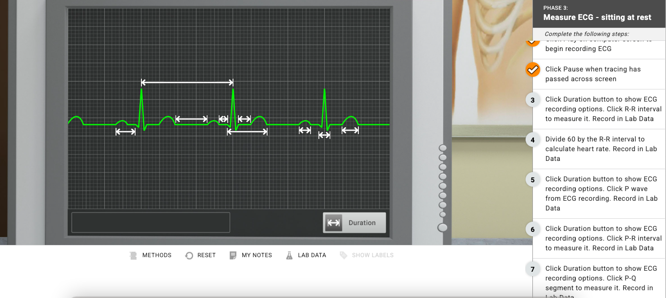 HELP ME WITH THIS LAB PHASE 3: Measure ECG -