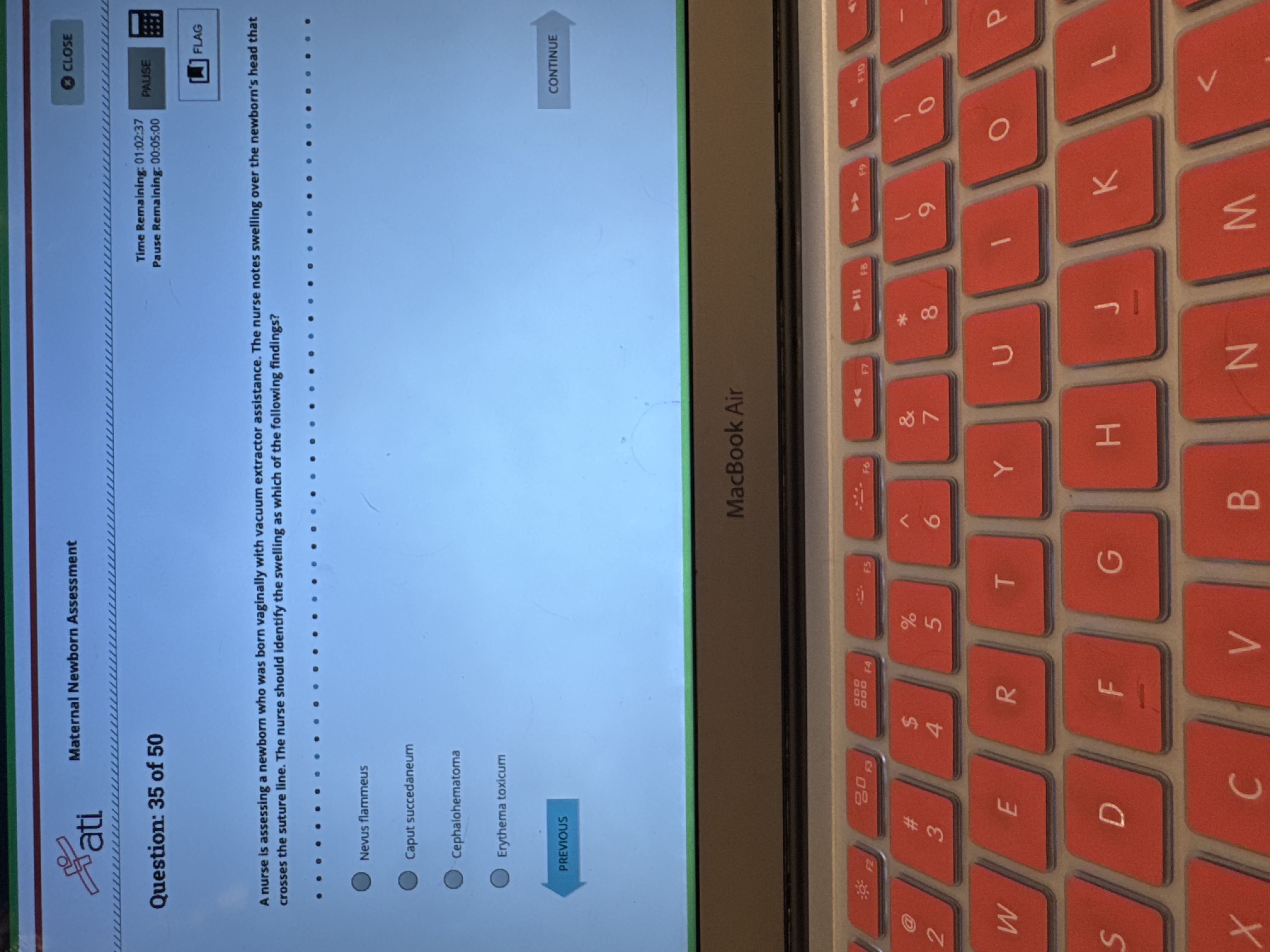 Pati Maternal Newborn Assessment CLOSE Time