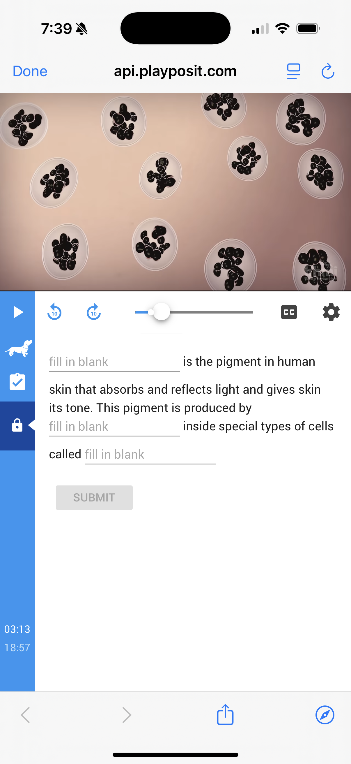 fill in blank is the pigment in human skin that