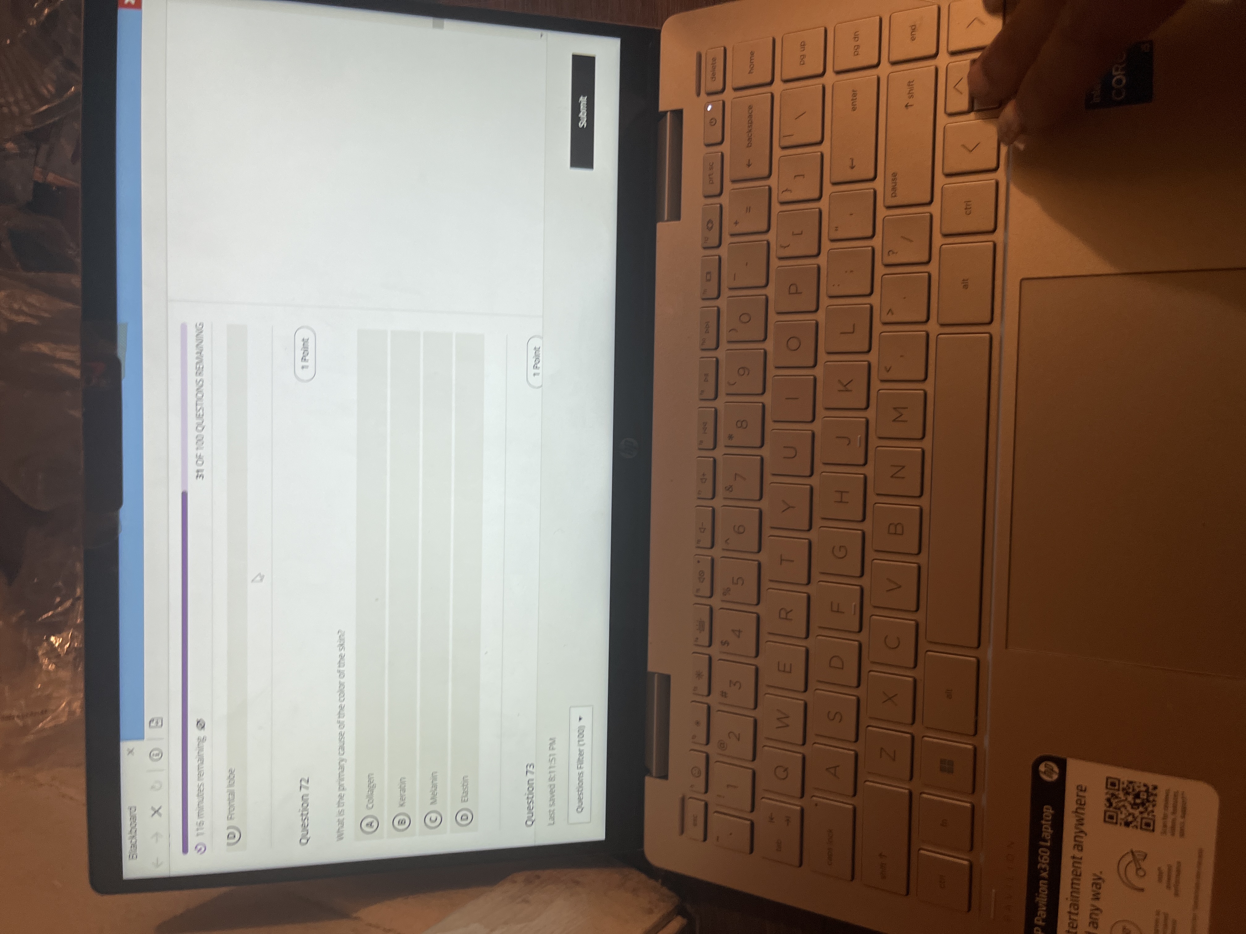 31 OF 100 QUESTIONS REMAINING 3 176 minutes