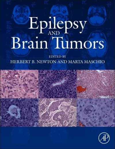 epilepsy and brain tumors 1st edition herbert b newton, marta maschio 0124171265, 9780124171268
