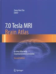 7.0 tesla mri brain atlas in-vivo atlas with cryomacrotome correlation 2nd edition zang hee cho 3642543987,