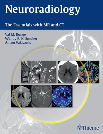 neuroradiology the essentials with mr and ct 1st edition val m runge, wendy r k smoker smoker, anton