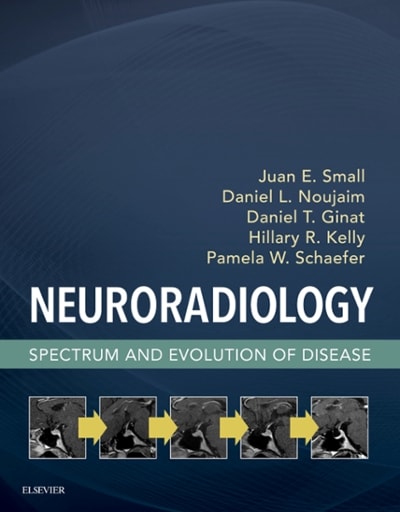 neuroradiology spectrum and evolution of disease 1st edition juan e small, daniel l noujaim, daniel t thomas