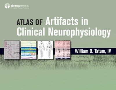 atlas of artifacts in clinical neurophysiology 1st edition william tatum iv 082616935x, 9780826169358