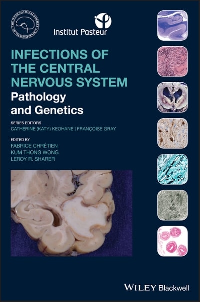 infections of the central nervous system pathology and genetics 1st edition fabrice chretien, kum thong wong,