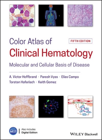 color atlas of clinical hematology molecular and cellular basis of disease 5th edition a victor hoffbrand,