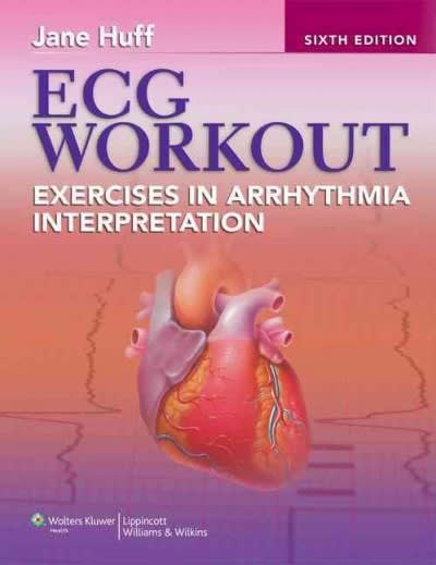 ecg workout exercises in arrhythmia interpretation 6th edition jane huff, huff 1451115539, 9781451115536