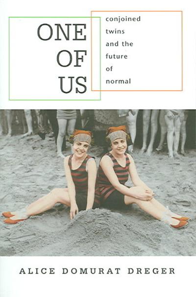 one of us conjoined twins and the future of normal 1st edition alice domurat dreger 0674018257, 9780674018259
