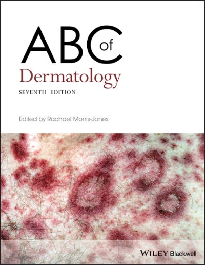 abc of dermatology 7th edition rachael morris jones 1119489008, 9781119489009
