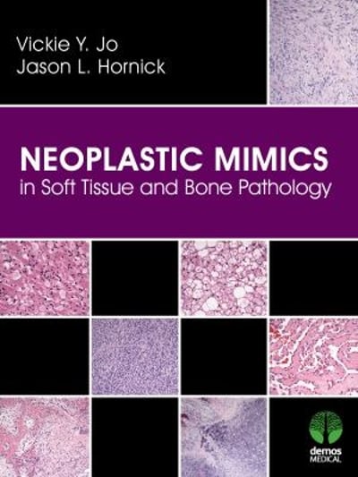 neoplastic mimics in soft tissue and bone pathology 1st edition vickie y jo, jason l hornick 1617052167,