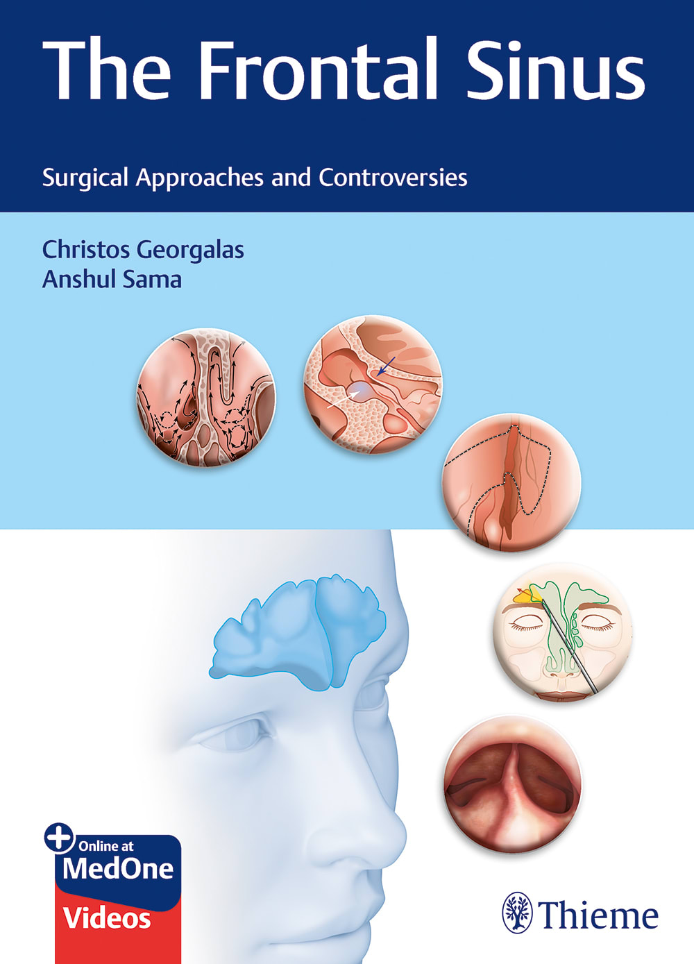 the frontal sinus surgical approaches and controversies 1st edition christos georgalas, anshul sama