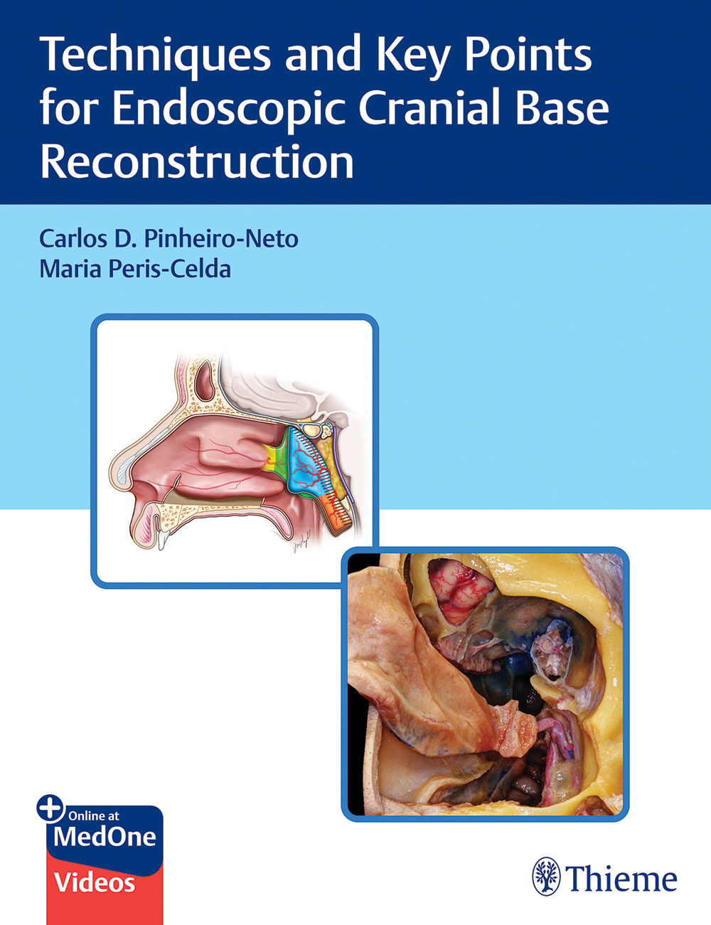 techniques and key points for endoscopic cranial base reconstruction 1st edition carlos pinheiro neto, maria