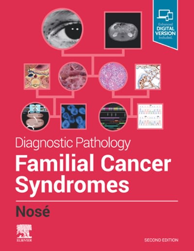 diagnostic pathology familial cancer syndromes e-book 2nd edition vania nosé 0323712053, 9780323712057