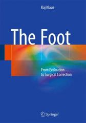 the foot from evaluation to surgical correction 1st edition kaj klaue 3662476975, 9783662476970