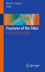 fractures of the tibia a clinical casebook 1st edition nirmal c tejwani 3319217747, 9783319217741