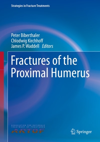 fractures of the proximal humerus 1st edition peter biberthaler, chlodwig kirchhoff, james p waddell