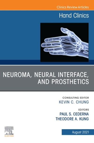 neuroma, neural interface, and prosthetics, an issue of hand clinics 1st edition paul stephen cederna,