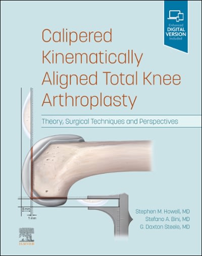 calipered kinematically aligned total knee arthroplasty theory, surgical techniques and perspectives 1st