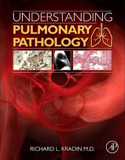 understanding pulmonary pathology applying pathological findings in therapeutic decision making 1st edition