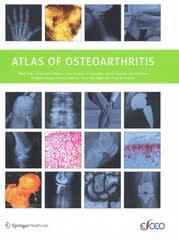 atlas of osteoarthritis 1st edition nigel arden, francisco blanco, cyrus cooper, ali guermazi, daichi