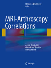 mri-arthroscopy correlations a case-based atlas of the knee, shoulder, elbow and hip 1st edition stephen f