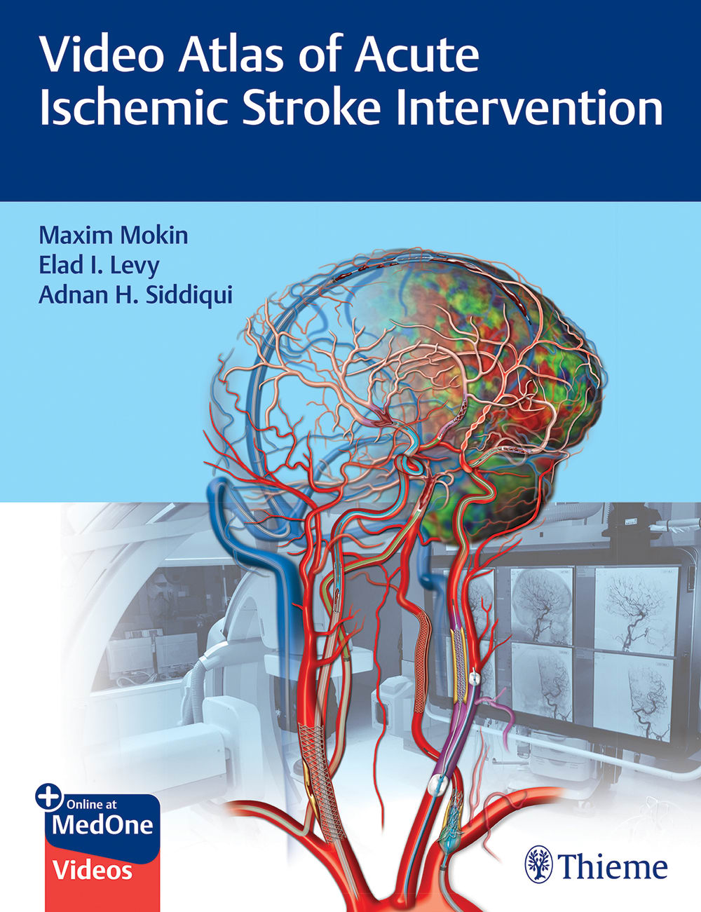 video atlas of acute ischemic stroke intervention 1st edition maxim mokin, elad levy, adnan siddiqui