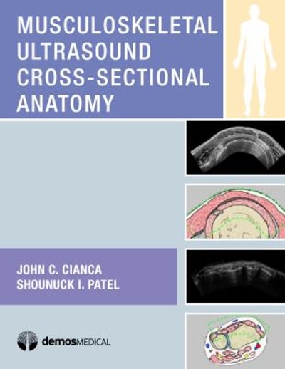 musculoskeletal ultrasound cross-sectional anatomy 1st edition john c cianca, shounuck i patel 1617052272,