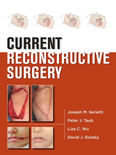 current reconstructive surgery 1st edition joseph m serletti, peter j taub, liza wu, david slutsky