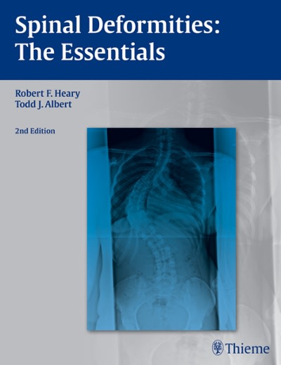 spinal deformities the essentials 2nd edition robert f heary, todd j albert 1604064129, 9781604064124