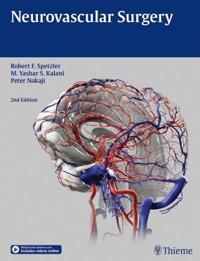neurovascular surgery 2nd edition robert f spetzler, m yashar s kalani, peter nakaji 1604067608, 9781604067606