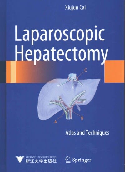 laparoscopic hepatectomy atlas and techniques 1st edition xiujun cai 9401798400, 9789401798402