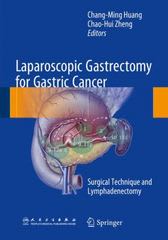 laparoscopic gastrectomy for gastric cancer surgical technique and lymphadenectomy 1st edition chang ming