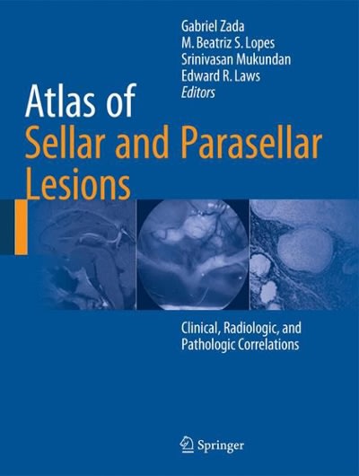atlas of sellar and parasellar lesions clinical, radiologic, and pathologic correlations 1st edition gabriel