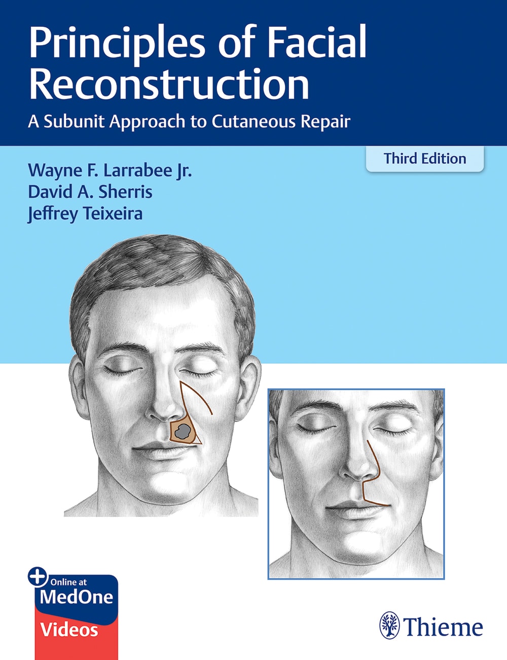 principles of facial reconstruction a subunit approach to cutaneous repair 3rd edition wayne f larrabee,