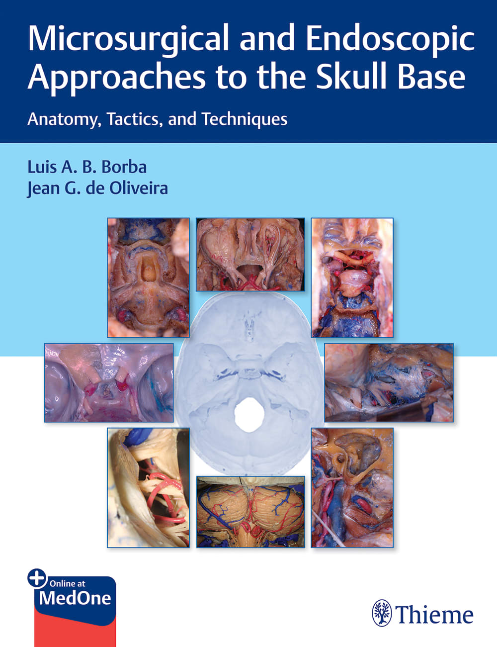 microsurgical and endoscopic approaches to the skull base anatomy, tactics, and techniques 1st edition luis