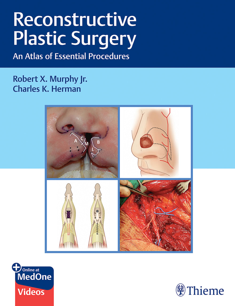 reconstructive plastic surgery an atlas of essential procedures 1st edition robert murphy, charles herman