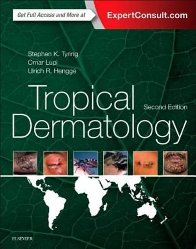 tropical dermatology 2nd edition steven k tyring, omar lupi, ulrich r hengge 032333914x, 9780323339148