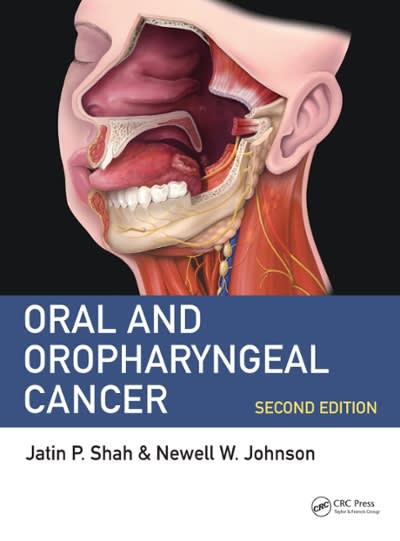 oral and oropharyngeal cancer 2nd edition jatin p facs md shah, newell w fmedsci mdsc cmg johnson 0429659954,