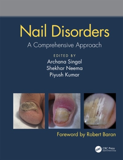 nail disorders a comprehensive approach 1st edition archana singal, shekhar neema, piyush kumar 1351139703,