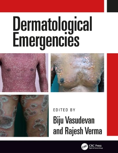 dermatological emergencies 1st edition rajesh verma, biju vasudevan 135116502x, 9781351165020