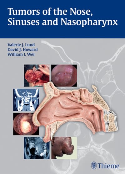 tumors of the nose, sinuses and nasopharynx 1st edition valerie j lund, david j howard, william i wei, w i