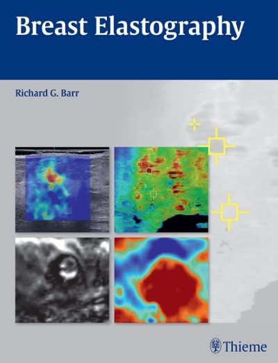 breast elastography 1st edition richard g barr 1604068531, 9781604068535