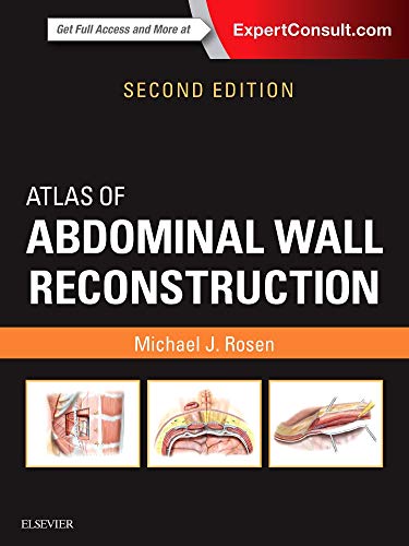 atlas of abdominal wall reconstruction 2nd edition michael j rosen 0323428053, 9780323428057