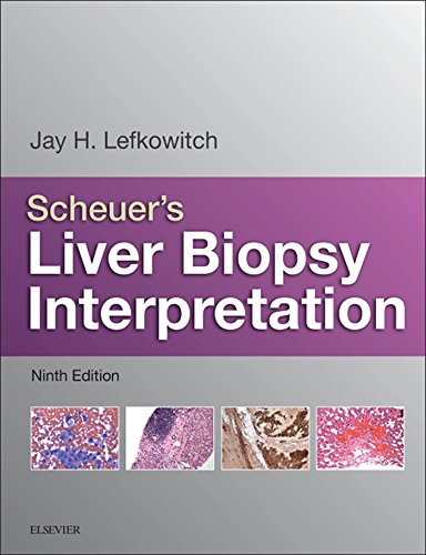 scheuers liver biopsy interpretation 9th edition jay h lefkowitch 0702066559, 9780702066559